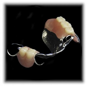 Metal incorporated denture Picture taken from trubyte.dentsply.com