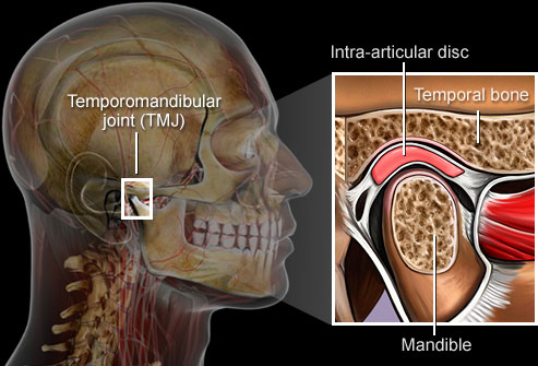 Temporomandibular Joint Disorder | Intelligent Dental