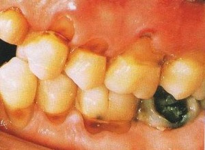 © Australian Denture Care Centre