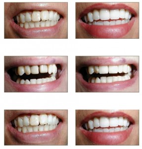 Dental correction for better smile @ clinicbay.com