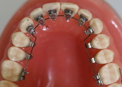 Define Orthodontist