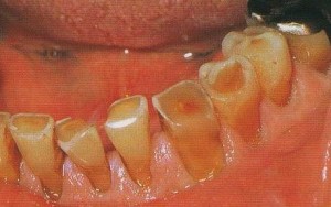 Â© Australian Denture Care Centre