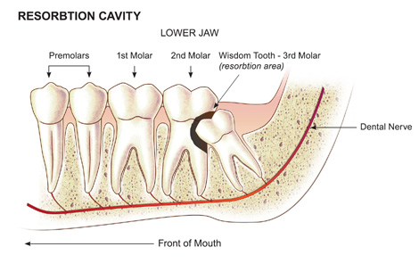 How Teeth Grow