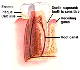 how to treat very sensitive teeth