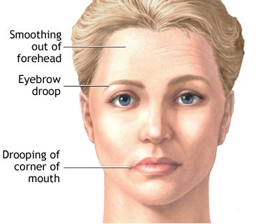 Facial Nerve Testing 12