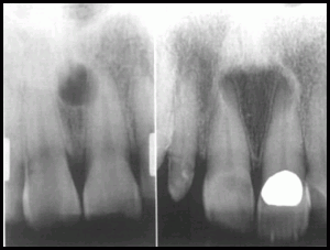 Radiographic Appearance of Cysts Part 3 and Scintigraphy | Intelligent