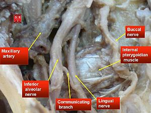 Inferior alveolar nerve Part 1 | Intelligent Dental