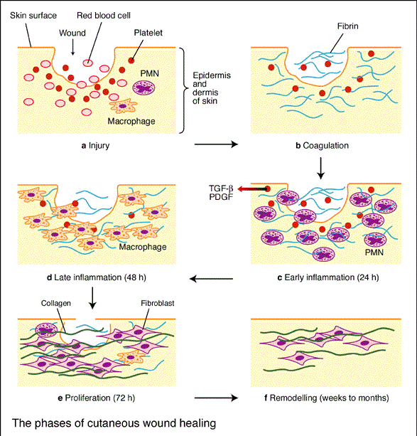 Wound Closure Techniques