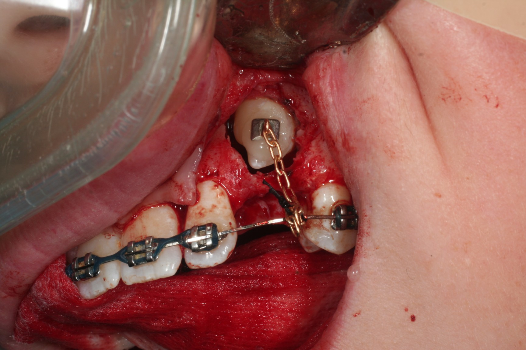 Oral Exposure 18
