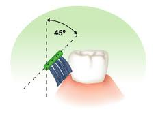 technique toothbrushing bass toothbrush brush brushing methods dental types teeth disease method tooth periodontal gum degrees tricks teaching health line