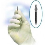 Mini Dental Implant Screw