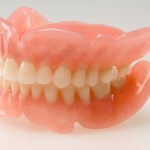 Permanent Dentures and its alternative