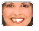 Enhance your smile with Teeth whitening 