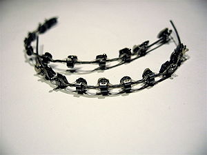 Dental braces, with a powerchain, removed afte...