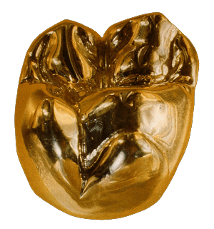 Dental crowns, gold crowns