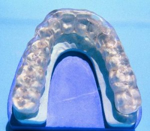 Mouth Guard for teeth grinding