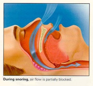 stop snoring at night naturally