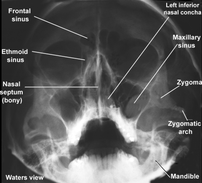 Indications of different types of extraoral radiographs Part 1